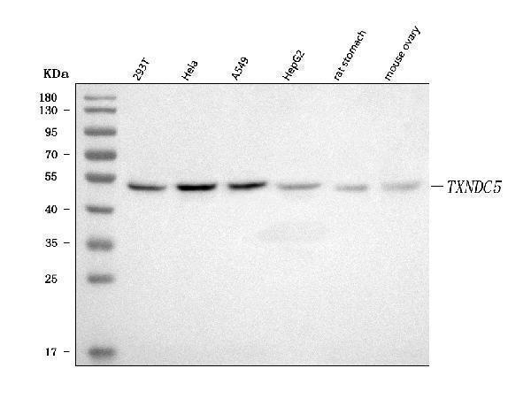  Western blot analysis of TXNDC5 using anti-TXNDC5 antibody (A05772-1)
