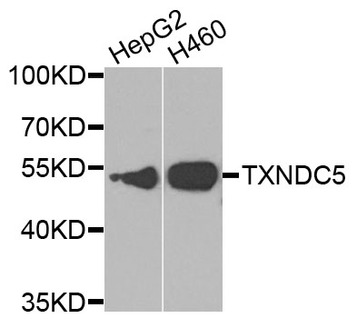 Western blot analysis of extracts of various cell lines, using TXNDC5 antibody
