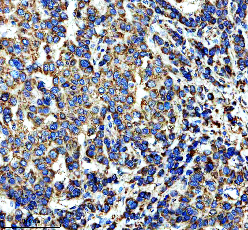 IHC analysis of FAM20A using anti-FAM20A antibody (A05777-1)