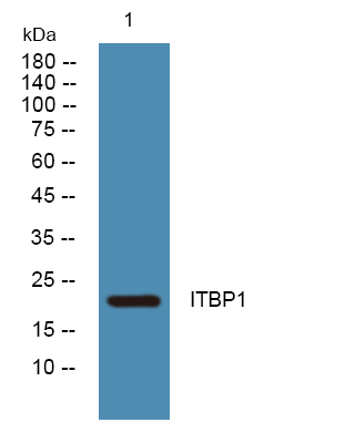 Western blot analysis of lysates from K562 cells, primary antibody was diluted at 1:1000, 4°over night