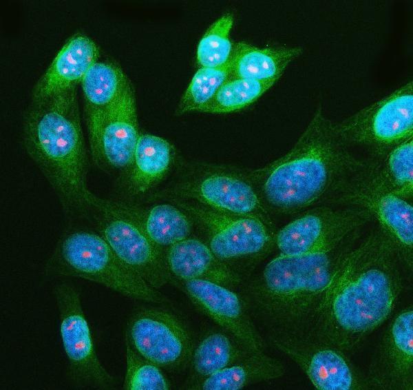  IF analysis of WDR36 using anti-WDR36 antibody (A05779-1) and anti-Tubulin Alpha antibody (M03989-3)