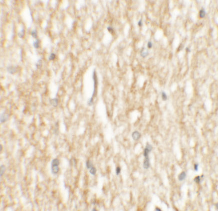 Immunohistochemistry of PHOX2A in human brain tissue with PHOX2A antibody at 2