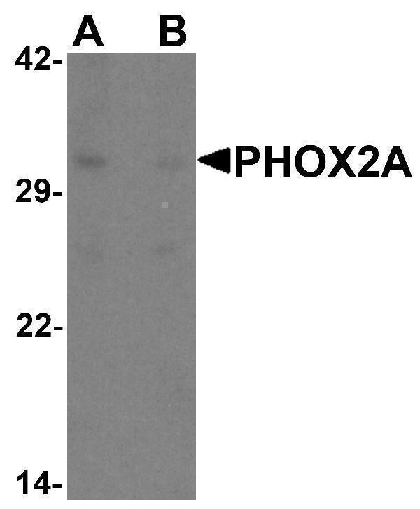 Western blot analysis of PHOX2A in rat brain tissue lysate with PHOX2A antibody at 1 μg/ml in (A) the absence and (B) the presence of blocking peptide