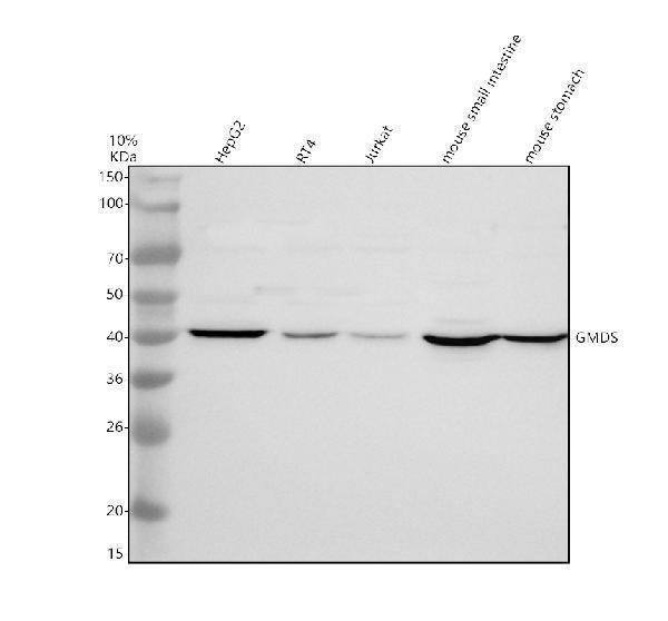 Western blot analysis of GMDS using anti-GMDS antibody (A05783-1)