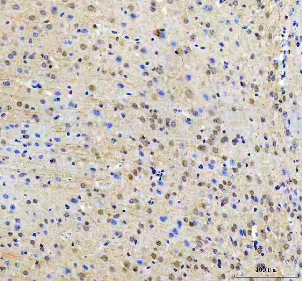  IHC analysis of RTF1 using anti-RTF1 antibody (A05784-1)