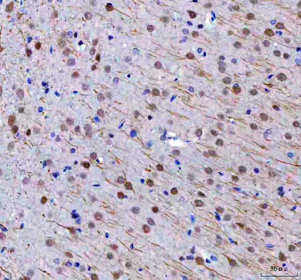 a05784 1 rtf1 primary antibodies ihc testing 3