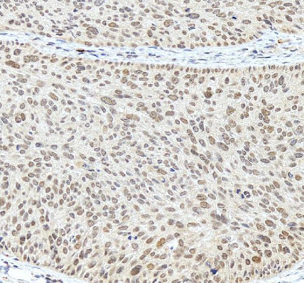 IHC analysis of RTF1 using anti-RTF1 antibody (A05784-1)