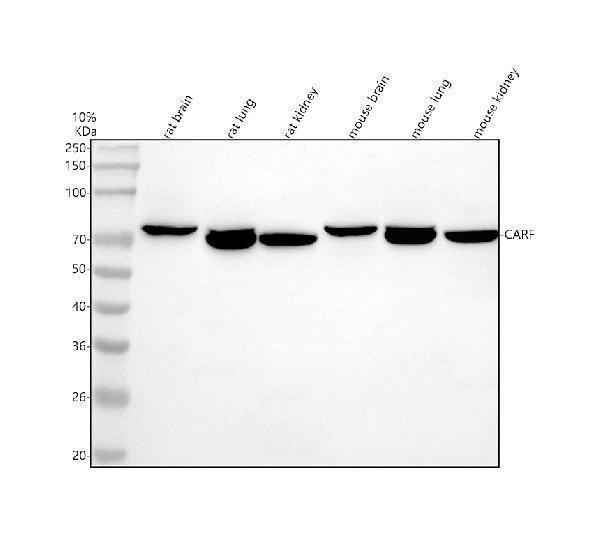  Western blot analysis of CDKN2AIP/CARF using anti-CDKN2AIP/CARF antibody (A05786-1)