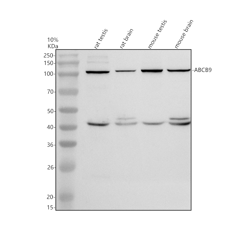 Western blot analysis of ABCB9 using anti-ABCB9 antibody (A05792)