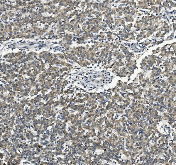 a05794 sorbs3 primary antibodies ihc testing 2