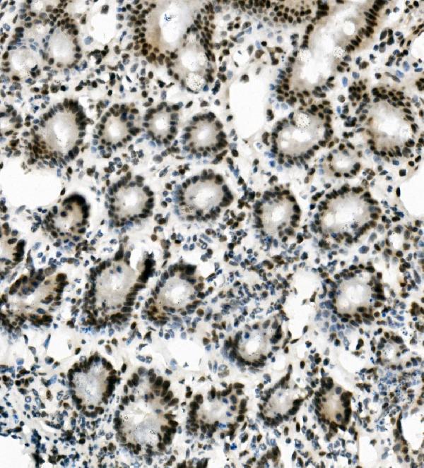 a05794 sorbs3 primary antibodies ihc testing 3