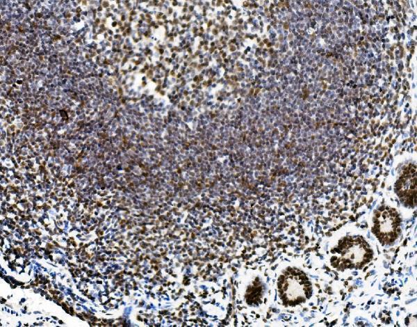 a05794 sorbs3 primary antibodies ihc testing 5