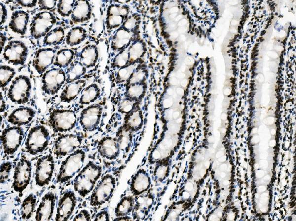 a05794 sorbs3 primary antibodies ihc testing 6