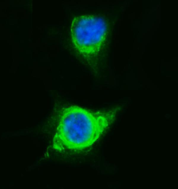a05794 sorbs3 primary antibodies ihc testing 7_