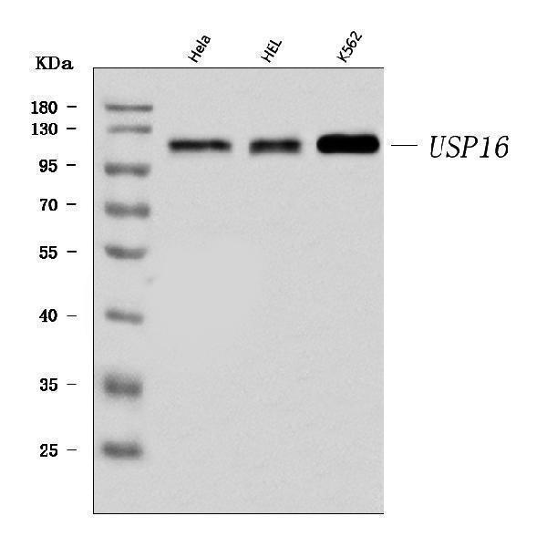  Western blot analysis of USP16 using anti-USP16 antibody (A05795-2)