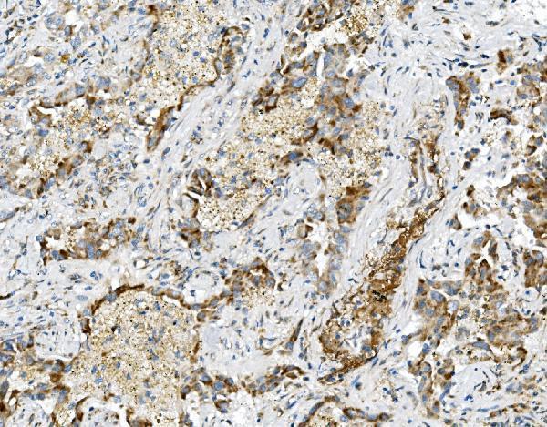 a05795 usp16 primary antibodies ihc testing 2