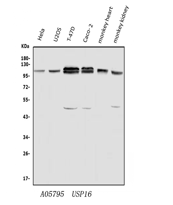 Western blot analysis of USP16 using anti-USP16 antibody (A05795).