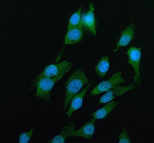a05796 3 clta primary antibodies if testing 1