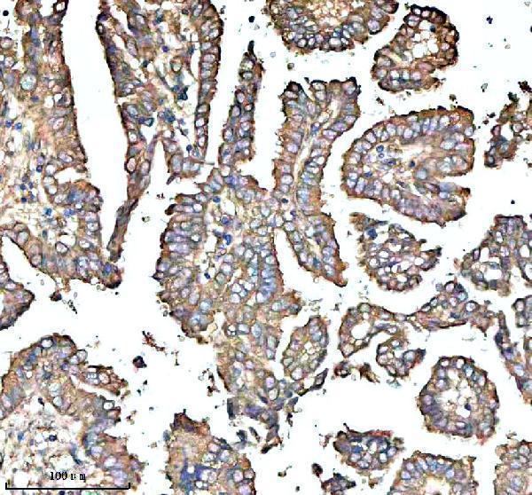 a05796 3 clta primary antibodies ihc testing 1