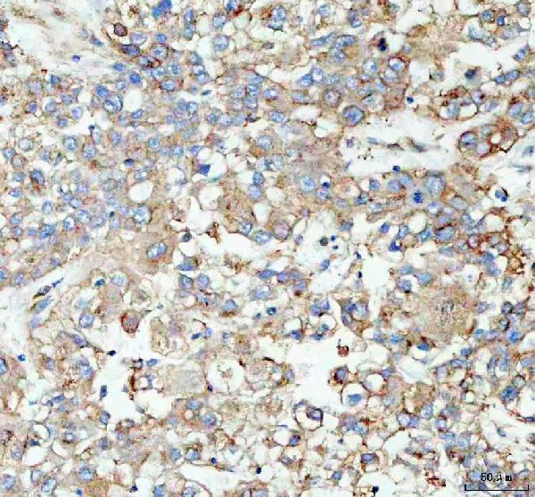  IHC analysis of CLTA using anti-CLTA antibody (A05796-3)