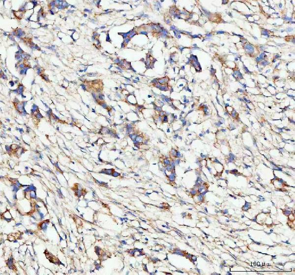  IHC analysis of CLTA using anti-CLTA antibody (A05796-3)