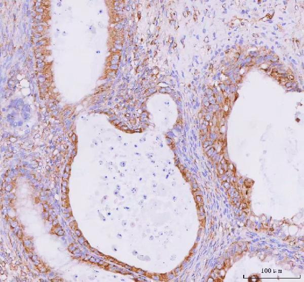 a05796 3 clta primary antibodies ihc testing 4