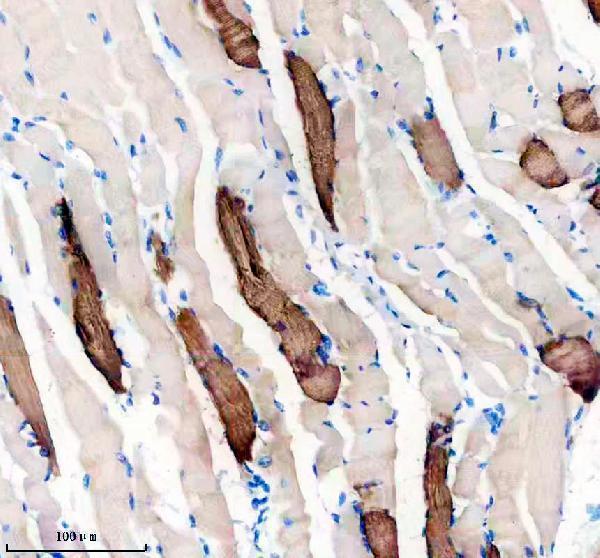 a05799 2 tnnt1 primary antibodies ihc testing 1