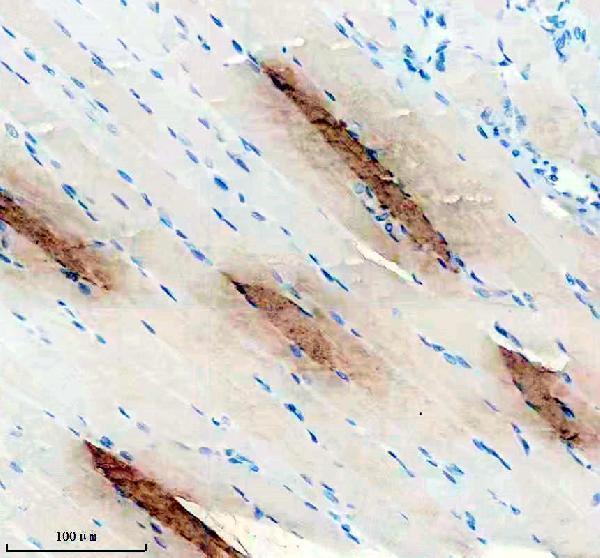 a05799 2 tnnt1 primary antibodies ihc testing 2