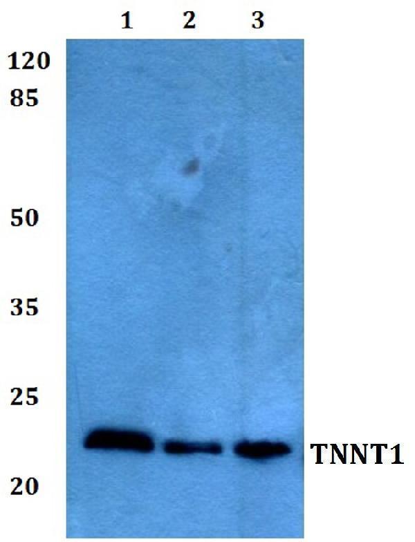 a05799t1 tnnt1 primary antiboties wb testing 1