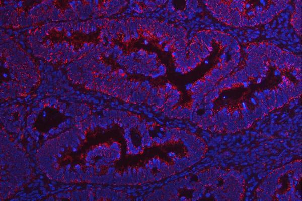 a05801 2 ndufv2 primary antibodies if testing 5