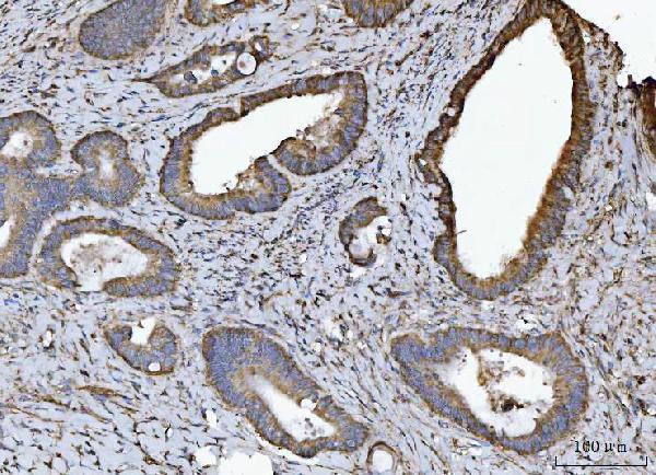  IHC analysis of NDUFV2 using anti-NDUFV2 antibody (A05801-2)