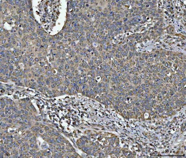  IHC analysis of NDUFV2 using anti-NDUFV2 antibody (A05801-2)