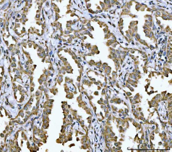 a05801 2 ndufv2 primary antibodies ihc testing 4