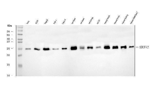  Western blot analysis of NDUFV2 using anti-NDUFV2 antibody (A05801-2)