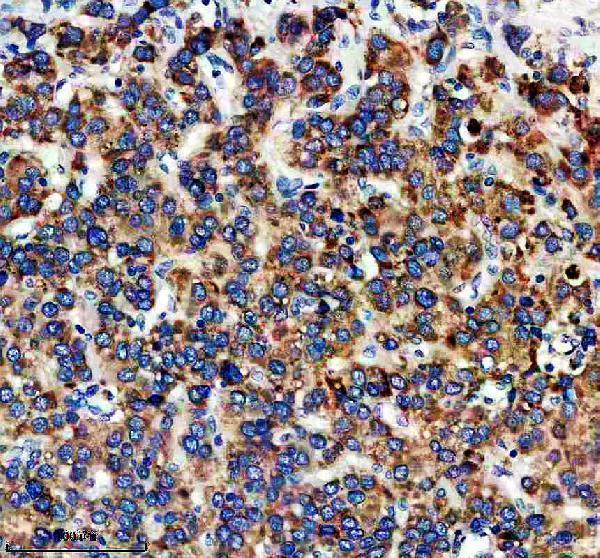 IHC analysis of DNAJB11 using anti-DNAJB11 antibody (A05802-1)
