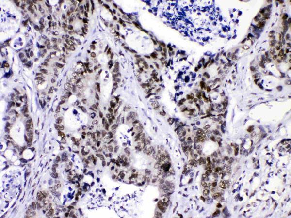 a05806 4 ihc anti hnrnp f picoband antibody