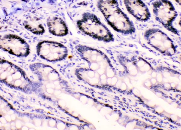 IHC analysis of HnRNPF using anti-HnRNPF antibody (A05806). HnRNPF was detected in paraffin-embedded section of rat intestine tissues. Heat mediated antigen retrieval was performed in citrate buffer (pH6, epitope retrieval solution) for 20 mins. The tissue section was blocked with 10% goat serum. The tissue section was then incubated with 1μg/ml rabbit anti-HnRNPF Antibody (A05806) overnight at 4°C. Biotinylated goat anti-rabbit IgG was used as secondary antibody and incubated for 30 minutes at 37°C. The tissue section was developed using Strepavidin-Biotin-Complex (SABC)(Catalog # SA1022) with DAB as the chromogen.