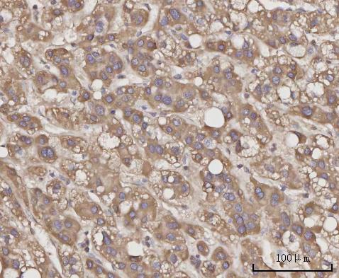  IHC analysis of CCL23 using anti-CCL23 antibody (A05808-1)