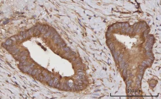  IHC analysis of CCL23 using anti-CCL23 antibody (A05808-1)