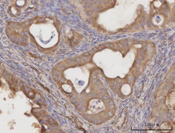  IHC analysis of CCL23 using anti-CCL23 antibody (A05808-1)