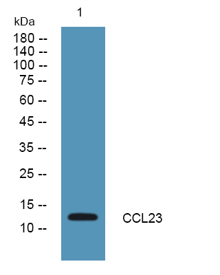 Western blot analysis of lysates from U2OS cells, primary antibody was diluted at 1:1000, 4°over night