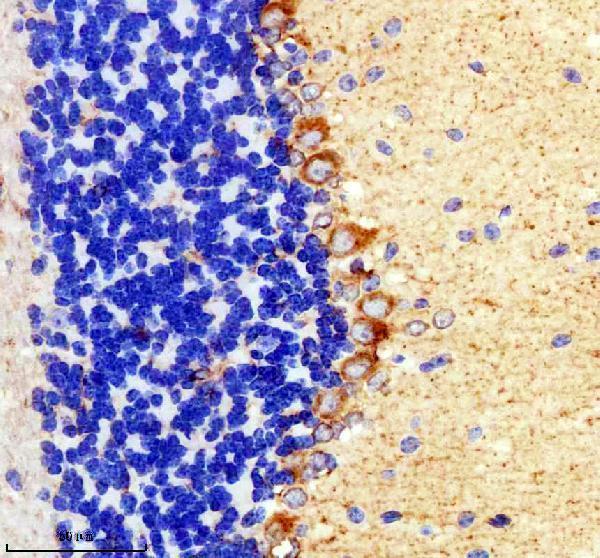 IHC analysis of TIGAR using anti-TIGAR antibody (A05811-2)