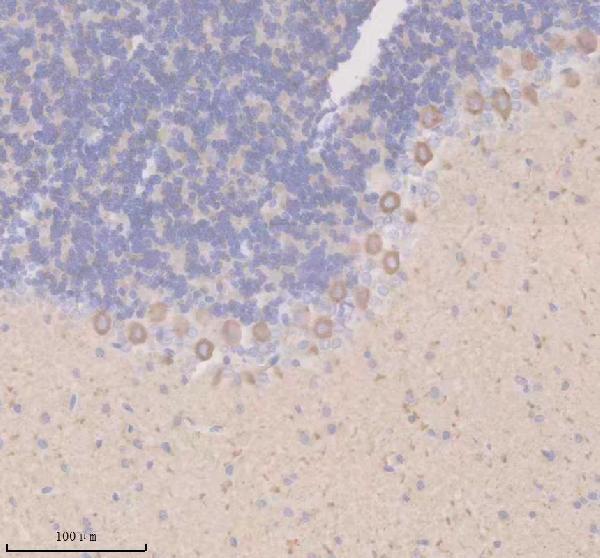 IHC analysis of TIGAR using anti-TIGAR antibody (A05811-2)