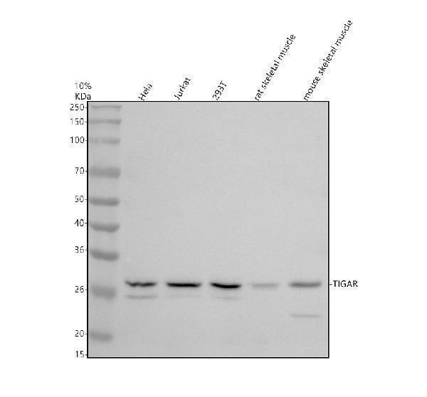Western blot analysis of TIGAR using anti-TIGAR antibody (A05811-2)