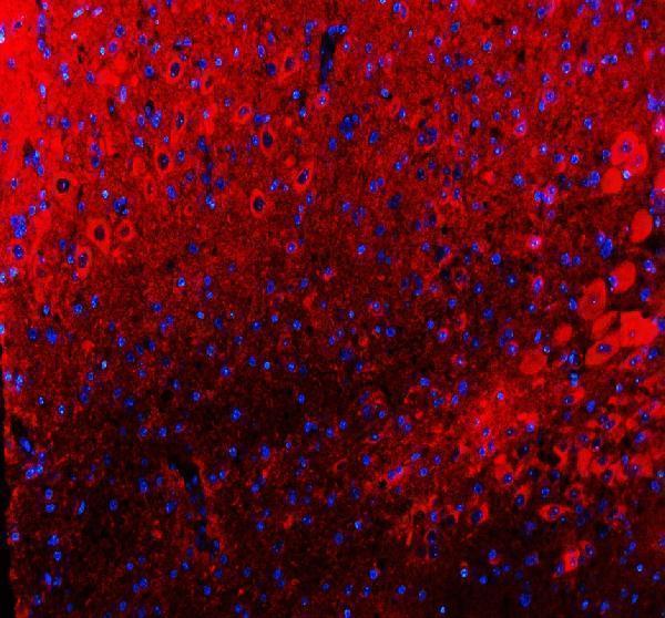 a05811 3 tigar primary antibodies if testing 1
