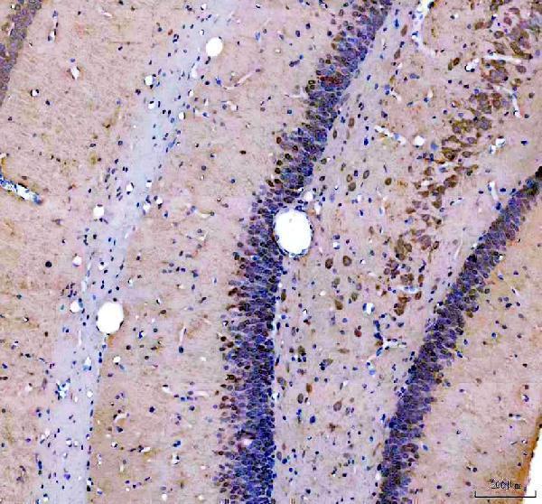 IHC analysis of TIGAR using anti-TIGAR antibody (A05811-3)