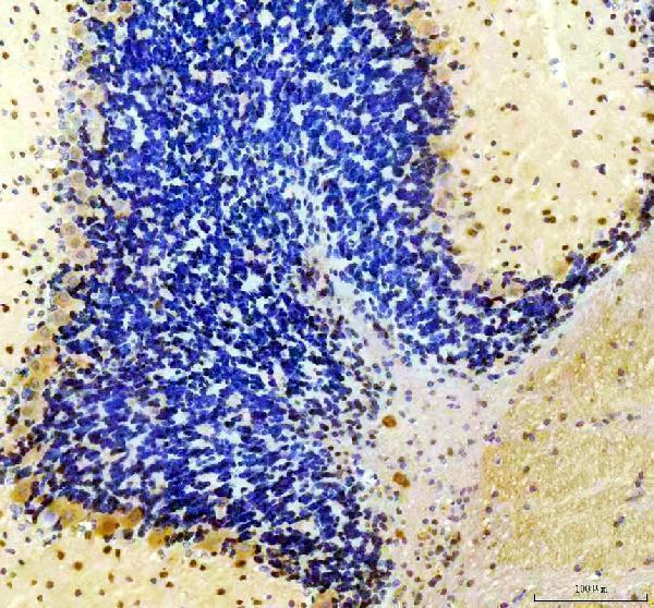 IHC analysis of TIGAR using anti-TIGAR antibody (A05811-3)