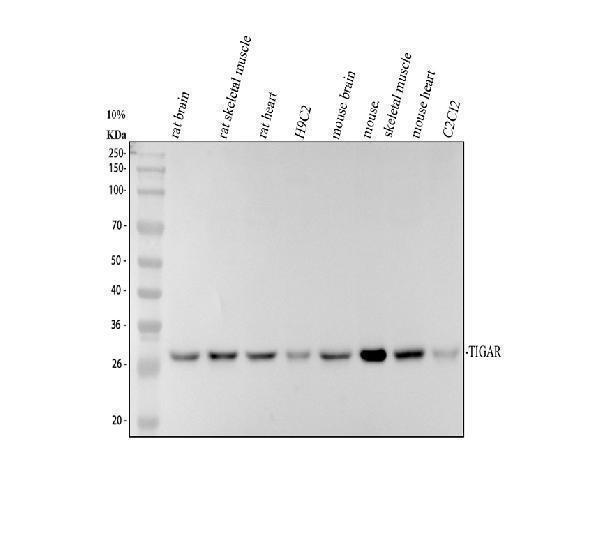 Western blot analysis of TIGAR using anti-TIGAR antibody (A05811-3)