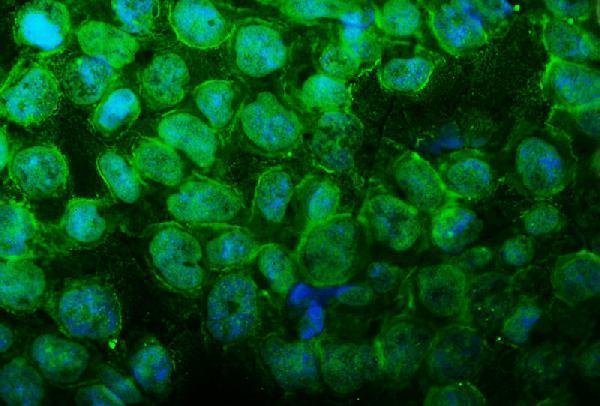a05812 2 ubr2 primary antibodies icc testing 5