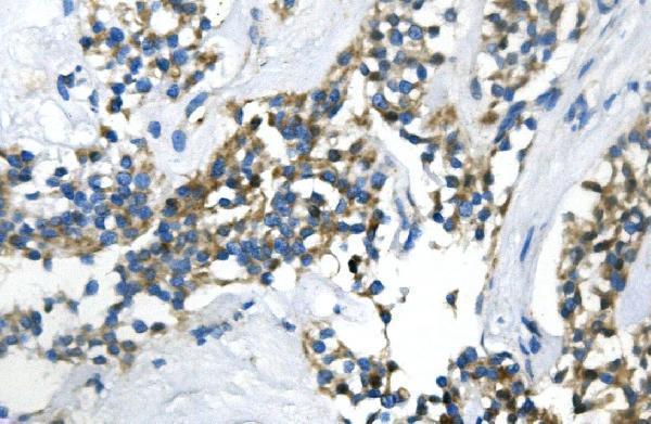  IHC analysis of UBR2 using anti-UBR2 antibody (A05812-2)